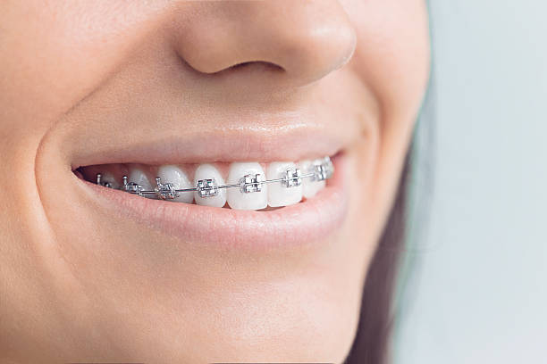 Best Dental Inlays and Onlays  in Gorevle, IL